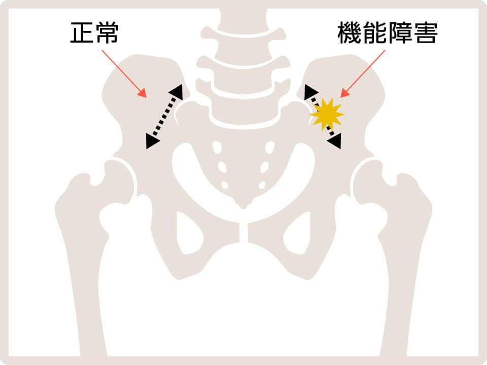 骨盤正面